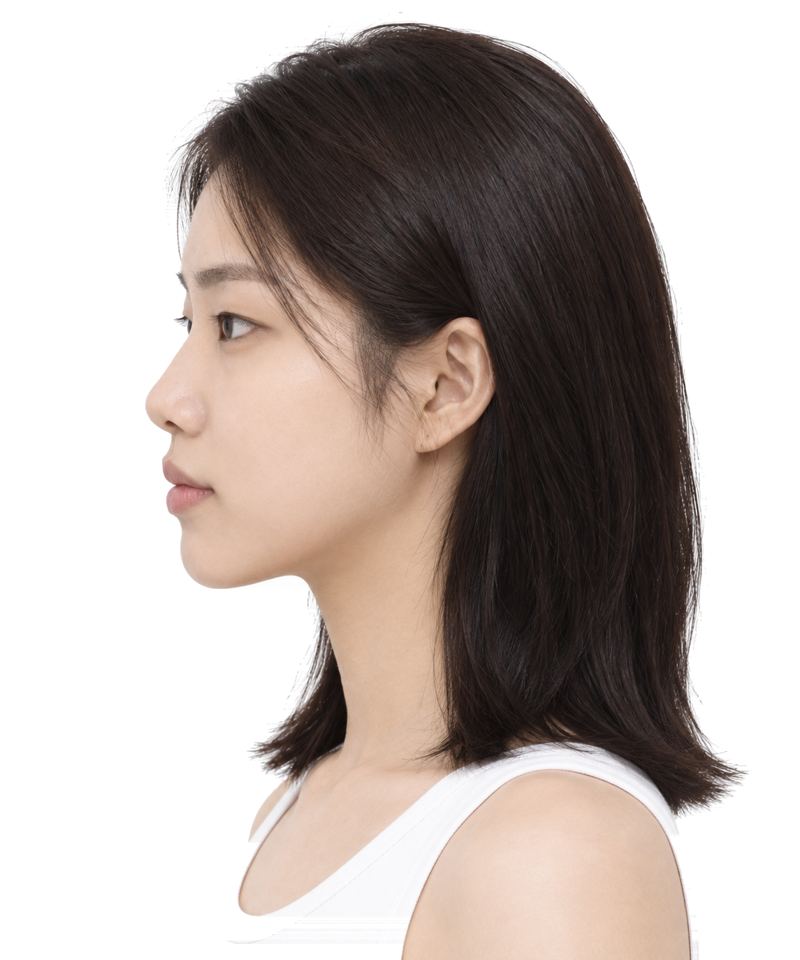 같은 모델의 우측 사진